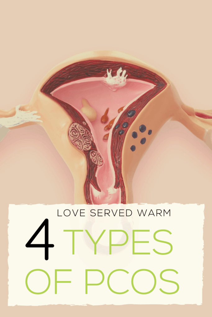 4 different types of PCOS